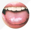 Tongue Dark Pale,Thin Greasy Tongue Coating