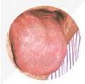 Enlarged Tender Tongue, as surface of mirror