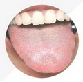 Pale Red Tongue,tongue coating thin and white