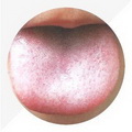 Enlarged Tender Tongue,with thin and white coating