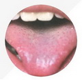 Thin Red Tongue,coating thin and white