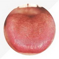 Thin Red Tongue,tongue coating yellow greasy