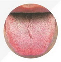 Red Tongue,rough coating