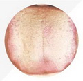 Enlarged Pale Tongue