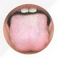 Pale tongue