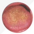 Rough Tongue Coating