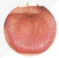 Thin Red Tongue