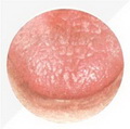Tough Tongue