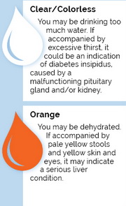 Turbid Urine Icon02