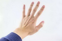 The obvious cause of blue veins in all parts of the body.