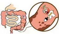 How to relieve constipation 06