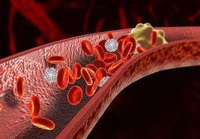 Introduction of The good way to lower blood pressure.