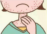 What to do about skin allergies.