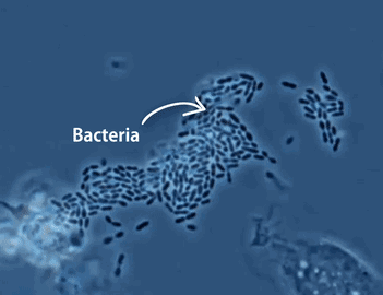 phagocytic cell
